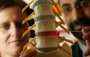 Symptome und Behandlung der Osteochondrose der Brustwirbelsäule
