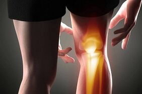 Zerstörung des Kniegelenks als Folge einer Arthrose